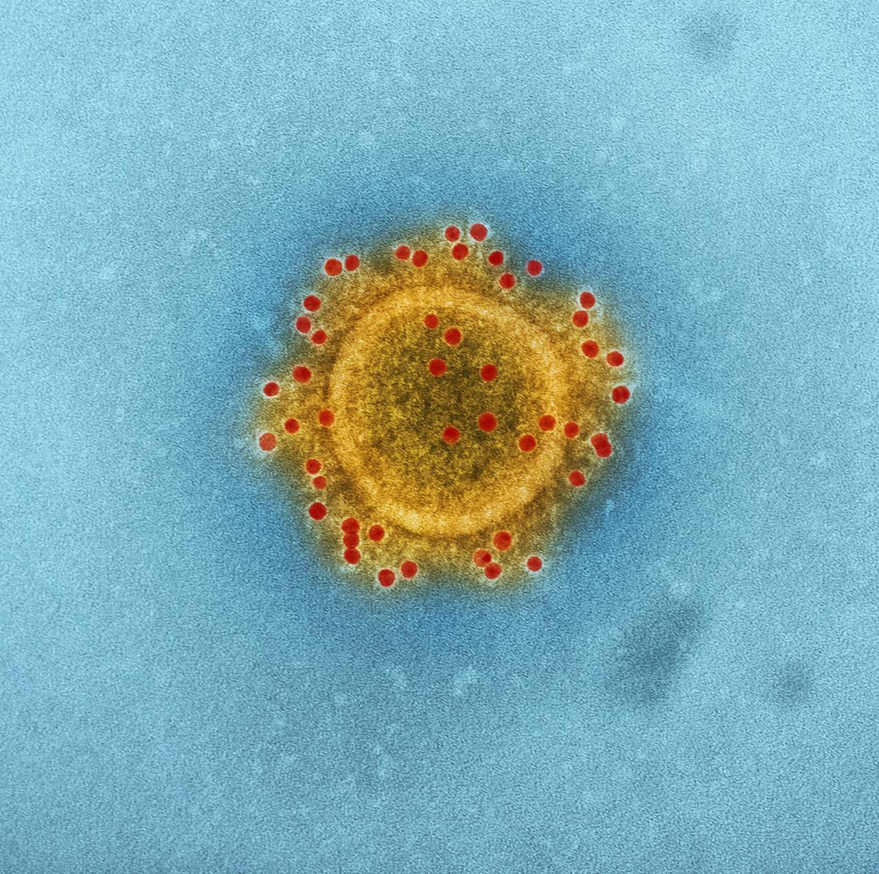 services-03 High-resolution image of coronavirus particle under electron microscope.
