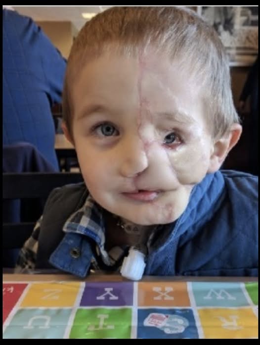 Boy, 5, survives savage attack by two dogs only to be called a ‘monster’ in public 616199602 122170153370789998 4971196606037772164 n