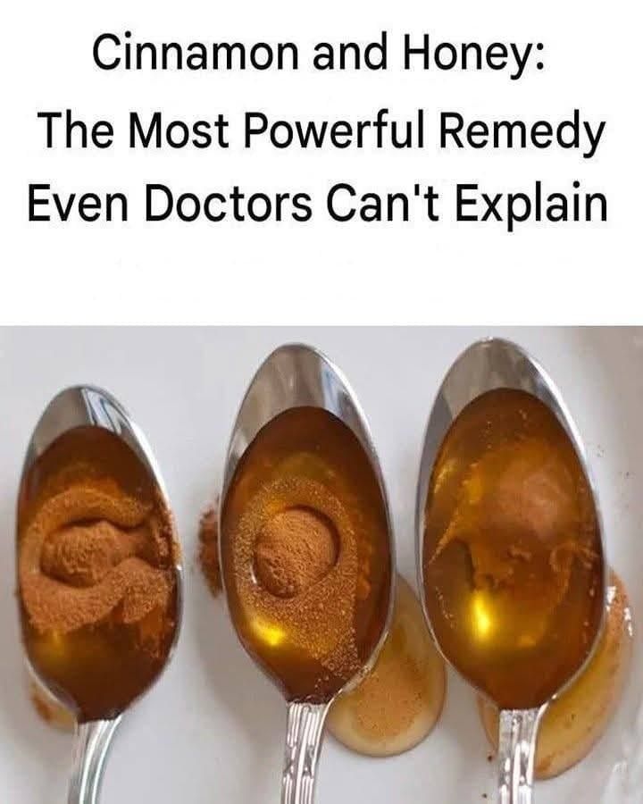 Cinnamon and Honey: The Most Powerful Remedy Even Doctors Can’t Explain 622368734 122171023088789998 3453913321434901635 n