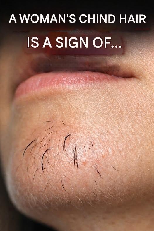 Why Chin Hair Grows in Women and What It May Indicate 678775302 122261514242155675 3894984088072158432 n