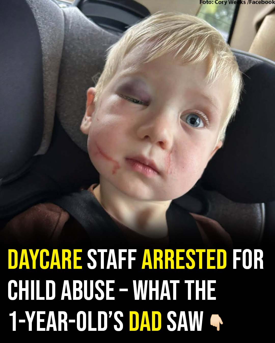 Daycare worker arrested after toddler arrives with black eye and swollen face on first day 681235518 122181718502789998 5011761966540654246 n