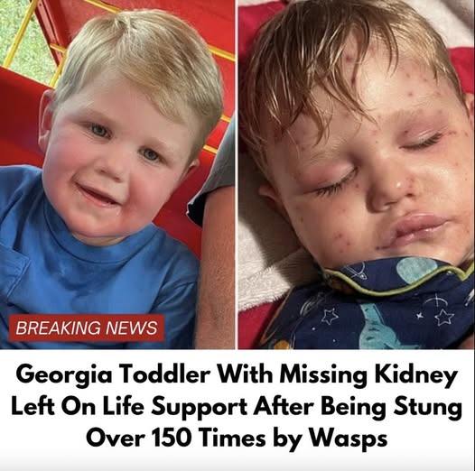 Georgia Toddler Stung Over 150 Times by Yellow Jackets, Currently Fighting for His Life: An Update on Beckham Reed’s Struggle 687033502 122182594982789998 4939981547943383480 n