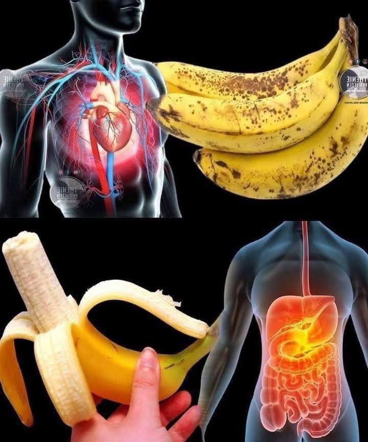 According to a doctor, eating bananas leads 697236862 122168702156876008 3922930044479453016 n